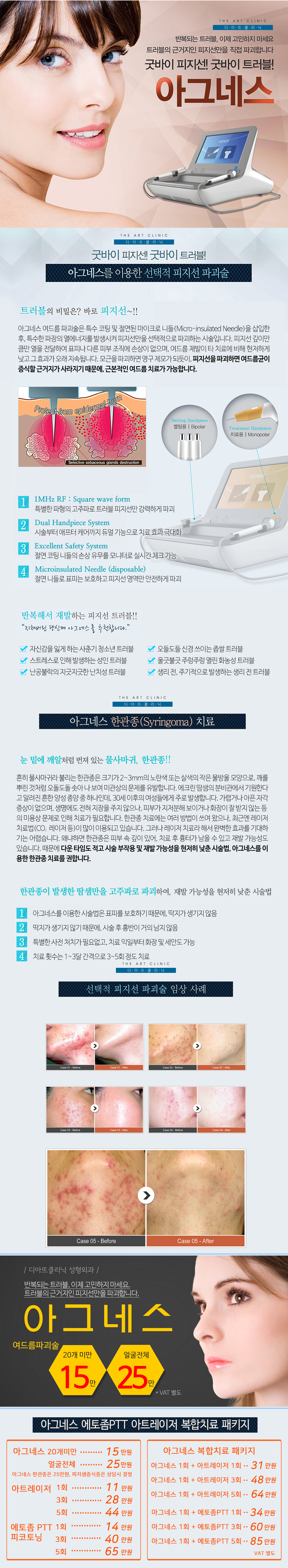 아그네스 대표 이미지 1